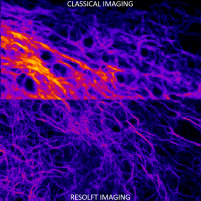 U2OS cells endogenously expressing vimentin rsEGFP2